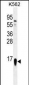 RPS19 Antibody (Center)