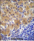 GGH Antibody (C-term)