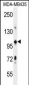 TRIM33 Antibody (C-term)