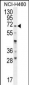 FUT4 Antibody (C-term)