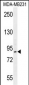 PCAF Antibody (N-term)