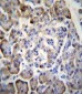 MDK Antibody (C-term)