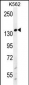 WRN Antibody (Center T802)