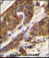 CFD Antibody (N-term)