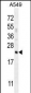 CFD Antibody (N-term)