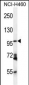 ENPEP Antibody (C-term)