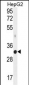 MED6 Antibody (C-term)