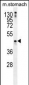 TRIM69  Antibody (N-term)