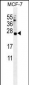 LKAAEAR1 Antibody (C-term)