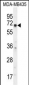 KCNQ1 Antibody (N-term)