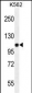 JAG1 Antibody (C-term)