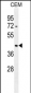 ACTBL3 Antibody (N-term)