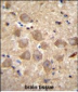 PCDHAC2 Antibody (Center)