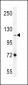 PCDHAC2 Antibody (Center)