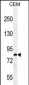 PCDHB3 Antibody (N-term)