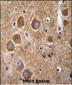 PAK6 Antibody (Center)