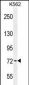 PAK6 Antibody (Center)