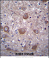 PPP3CC Antibody (N-term)