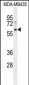 PPP3CC Antibody (N-term)