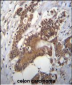 PCYT1A Antibody (N-term)