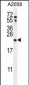 RAB10 Antibody (Center)