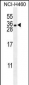 HLA-DQA1 Antibody (N-term)