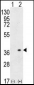 HLA-DQA1 Antibody (N-term)