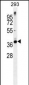 STX16 Antibody (C-term)