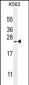 VEGFA Antibody (Center)