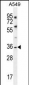 KCNK1 Antibody (C-term)