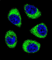 SLC25A6 Antibody (Center)