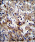 SLC25A6 Antibody (Center)