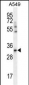 SLC25A6 Antibody (Center)