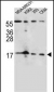 FGF22 Antibody (N-term)