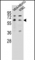 HTR3A Antibody (N-term)