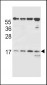 TCRB Antibody (Center)