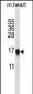 VSNL1 Antibody (Center)