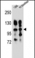 ITGA5 Antibody (Center)