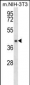 NUDT9 Antibody (C-term)