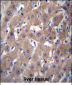 AKR1C2 Antibody (C-term)