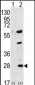 GREM1 Antibody (C-term)
