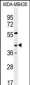 GPR45 Antibody (Center)