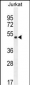 SNIP1 Antibody (N-term)