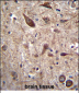 PTN Antibody (C-term)