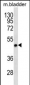 STX5 Antibody (Center)