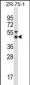 STX5 Antibody (Center)