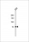 POU6F2 Antibody (N-term)