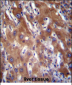 GNE Antibody (N-term)
