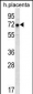 GNE Antibody (N-term)