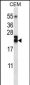 TNFSF4 Antibody (Center)